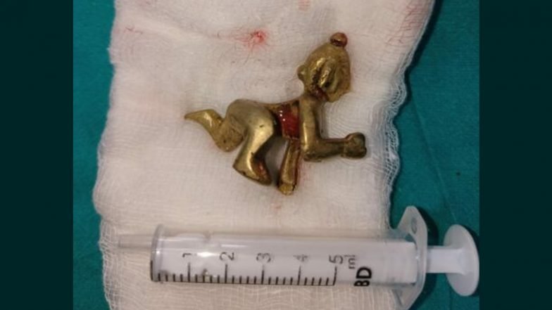 कर्नाटक: भगवान कृष्ण की मूर्ति को पवित्र जल के साथ निगलने के बाद सर्जिकल रूप से मनुष्य के खाने की नली से निकाला गया