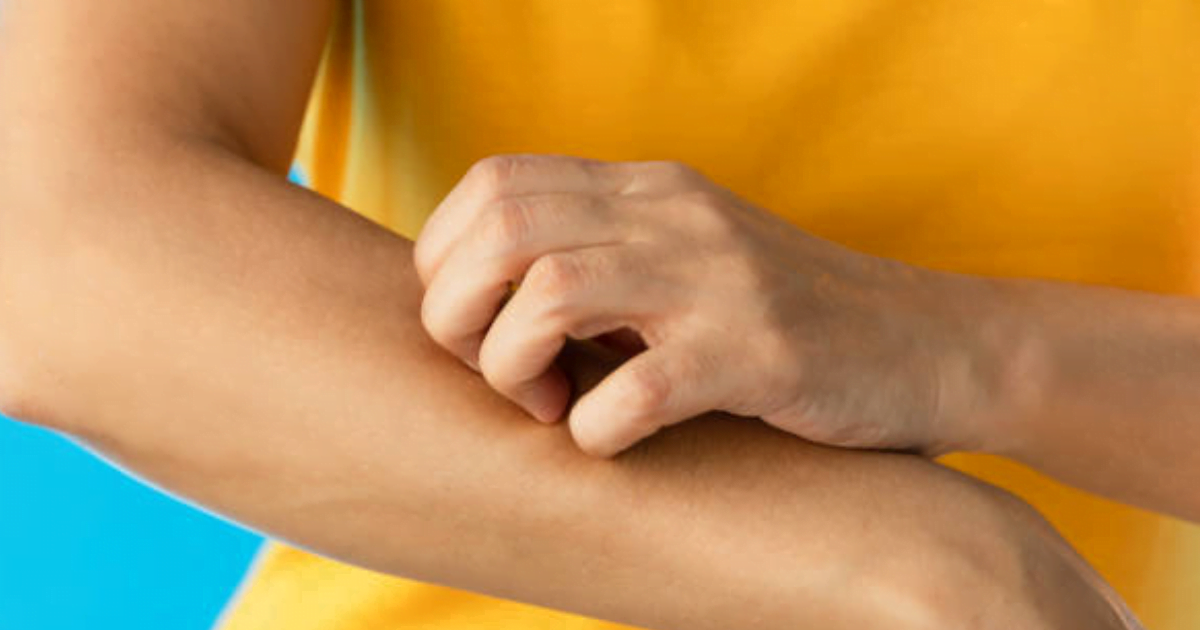 त्वचा पर गप्पी संकेत जो तत्काल ध्यान देने के लिए कहते हैं त्वचा पर गप्पी संकेत जो तत्काल ध्यान देने के लिए कहते हैं