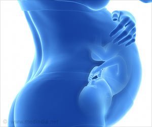 कलकत्ता उच्च न्यायालय ने 34 सप्ताह की गर्भवती महिला के गर्भपात की अनुमति दी