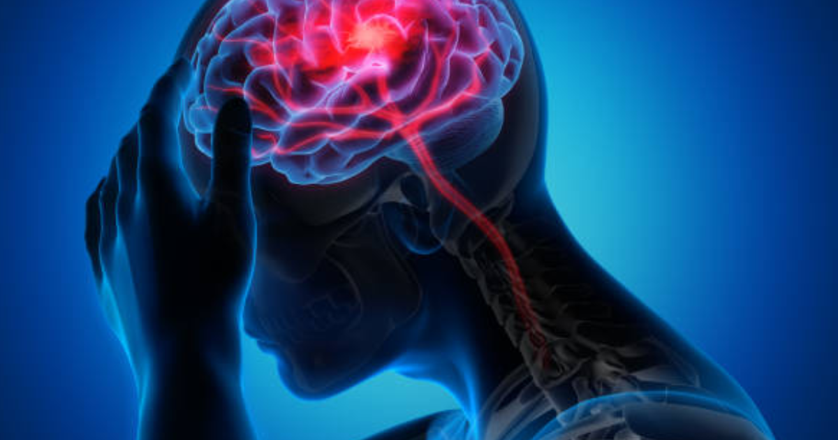 अध्ययन में पाया गया है कि स्ट्रोक से सालों पहले अवसादग्रस्तता के लक्षण देखे जा सकते हैं; जानिए आप संकेतों को कैसे पहचान सकते हैं अध्ययन में पाया गया है कि स्ट्रोक से सालों पहले अवसादग्रस्तता के लक्षण देखे जा सकते हैं; जानिए आप संकेतों को कैसे पहचान सकते हैं