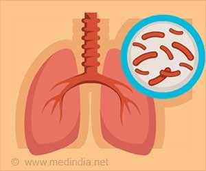 आइए 2025 तक भारत को टीबी मुक्त बनाएं: राष्ट्रपति राम नाथ कोविंद आइए 2025 तक भारत को टीबी मुक्त बनाएं: राष्ट्रपति राम नाथ कोविंद
