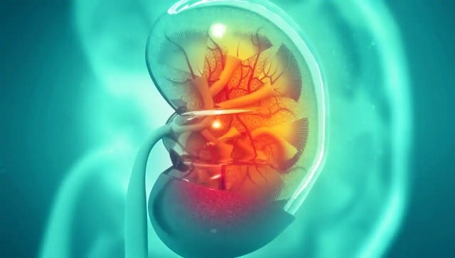 क्यों आनुवंशिक विकार हमारे गुर्दे को कमजोर बना सकते हैं